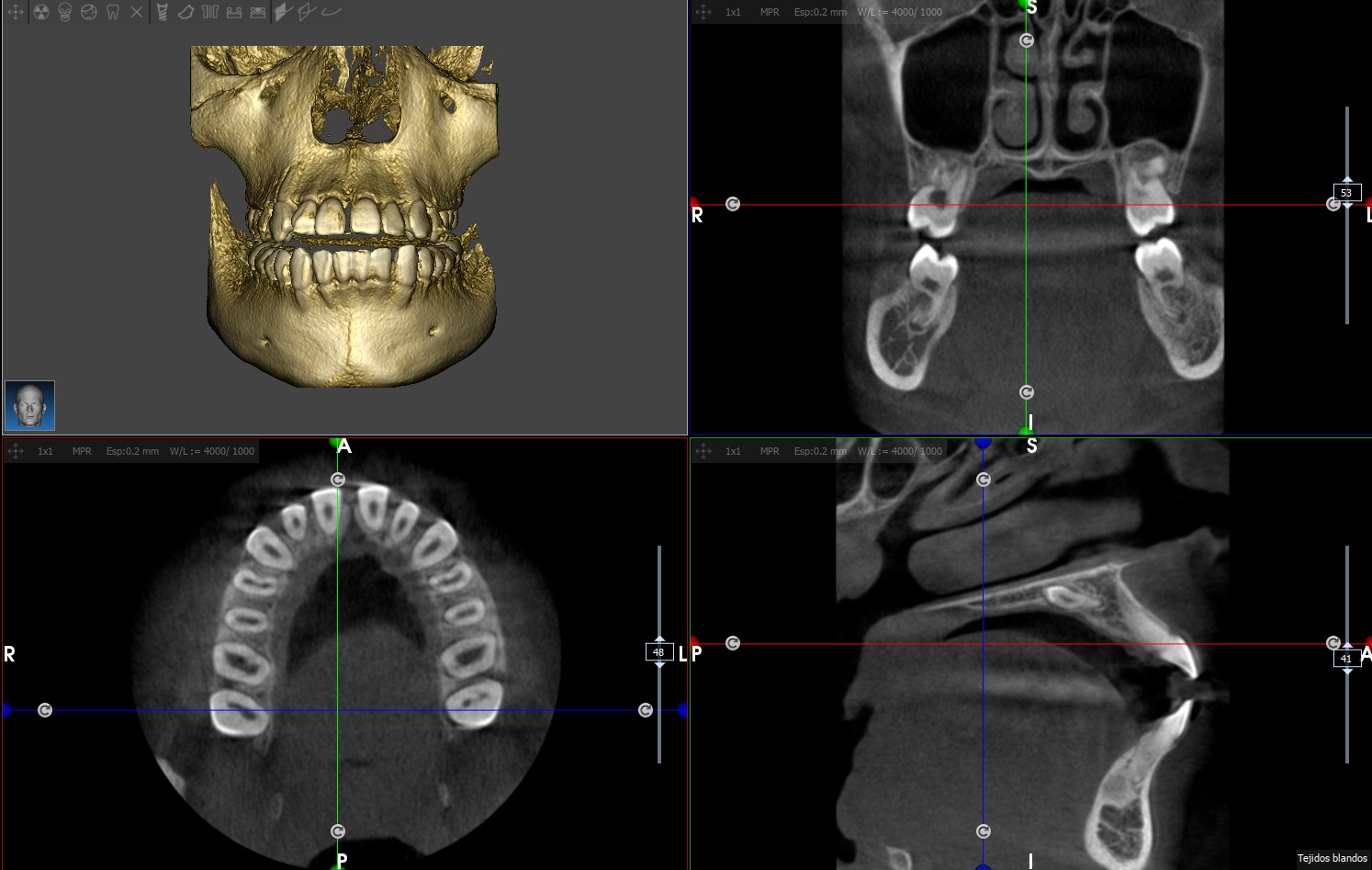 tomografías 3D